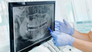 A dentist pointing at an X-ray